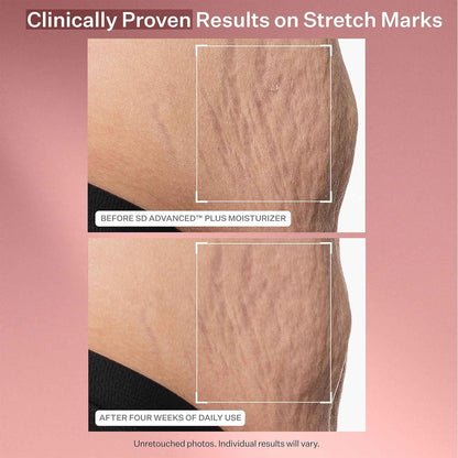 Strivectin Anti-Wrinkle Face Creams and Serums, with Ceramides & Peptides for Firm Skin, Less Wrinkles & Fine Lines & Targets Crow'S Feet